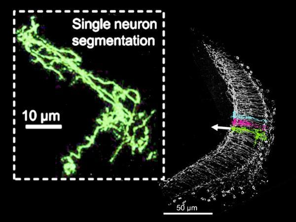  Image of a single neuron of a fruit fly’s eye made with super-resolution microscopy.