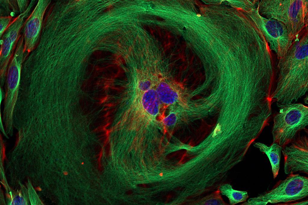 Microscopic image showing abnormal division of cancer cells.