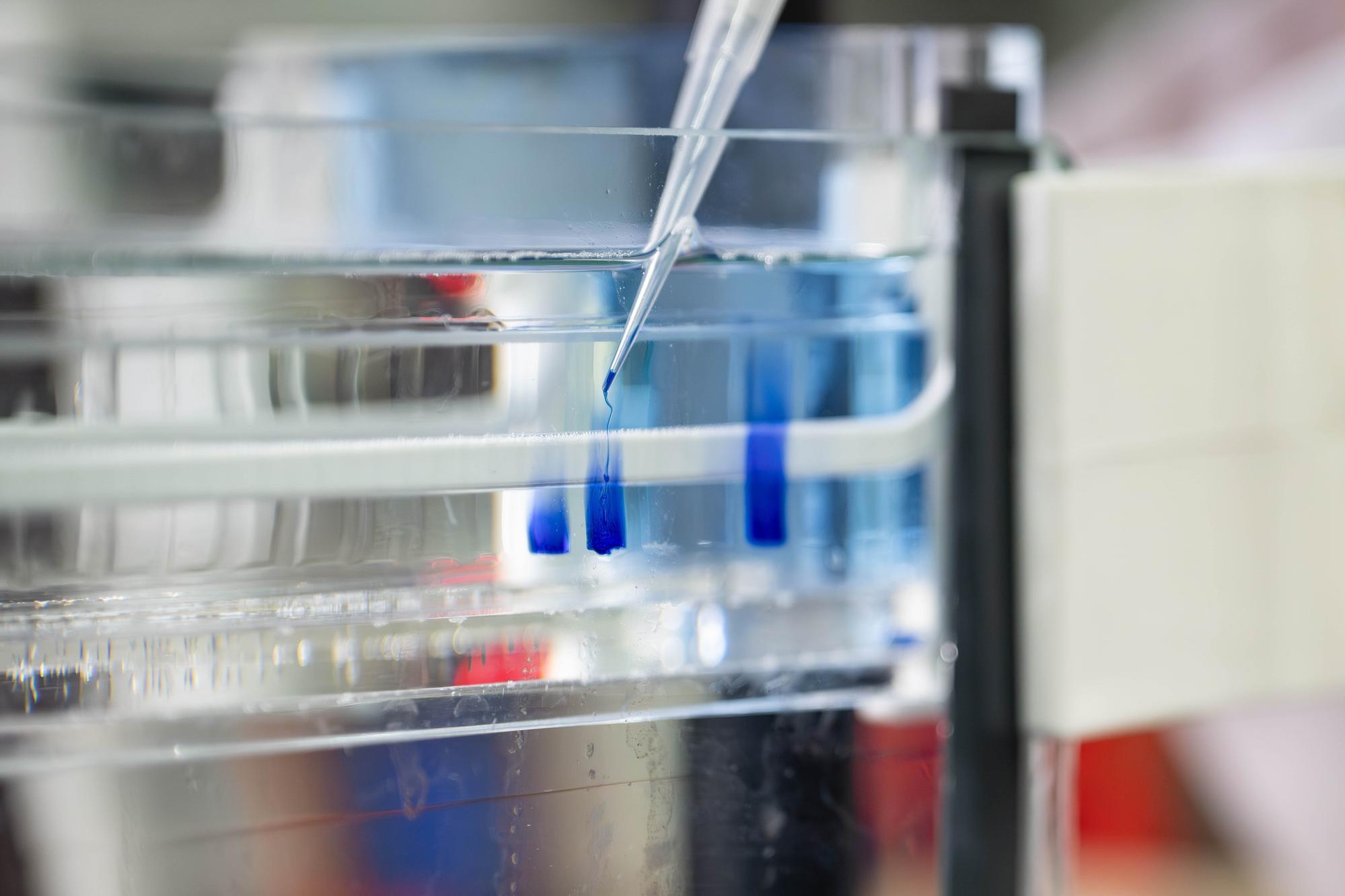 The NTHU research team used protein vertical electrophoresis experiments to study how hydrogen sulfide changes the protein structure of cancer cells.