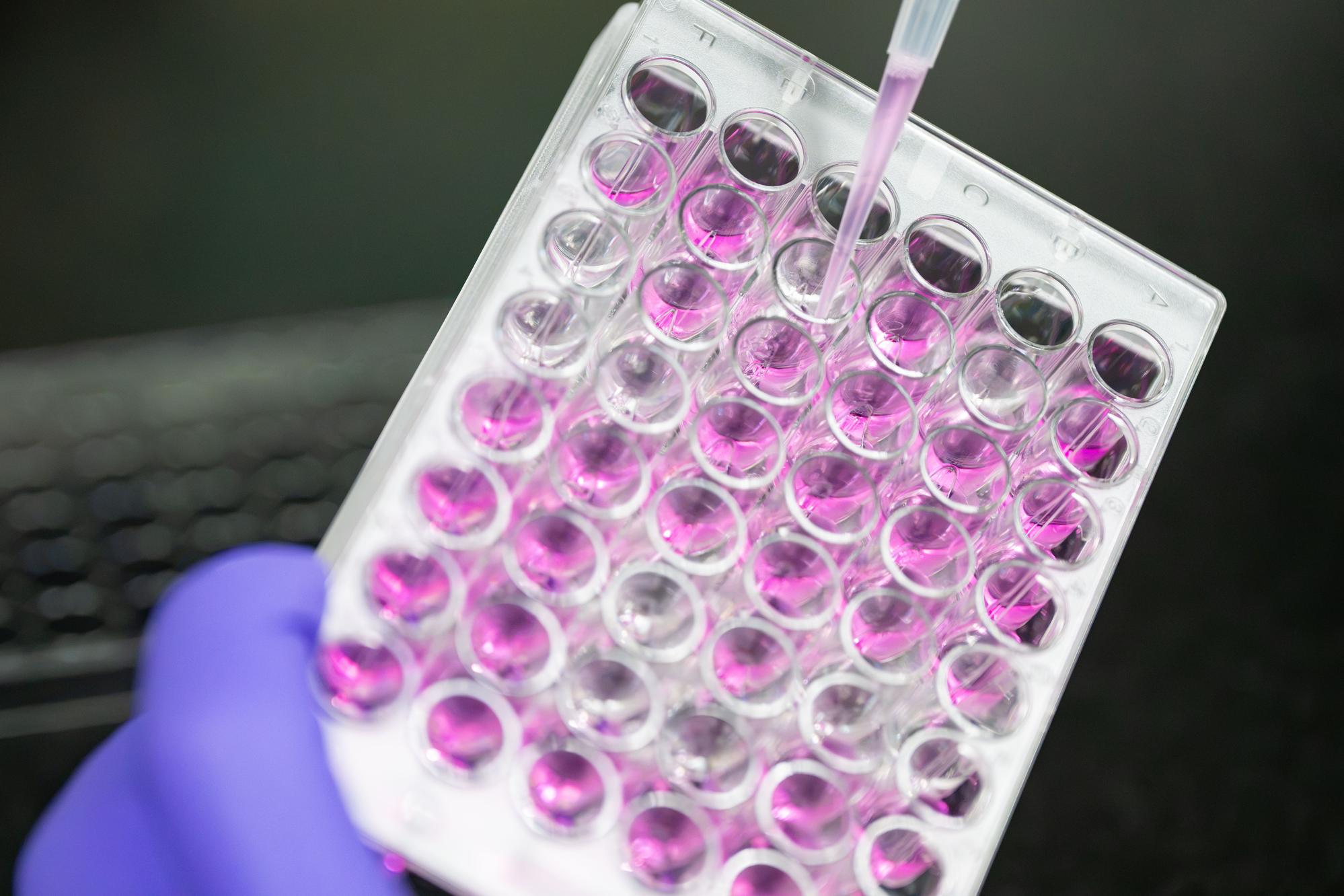 Cell experiments conducted by researchers at NTHU's Institute of Molecular Medicine demonstrate isorhoifolin's ability to promote neurite regrowth following injury.